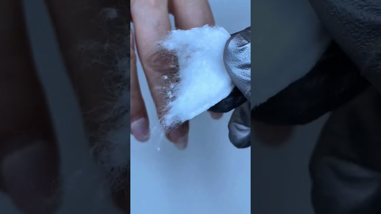 ЕСЛИ АЛЛЕРГИЯ НА ГЕЛЬ ЛАК 