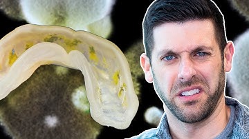 Getting a 3D Clean for your 3D Printed Splints and Guards