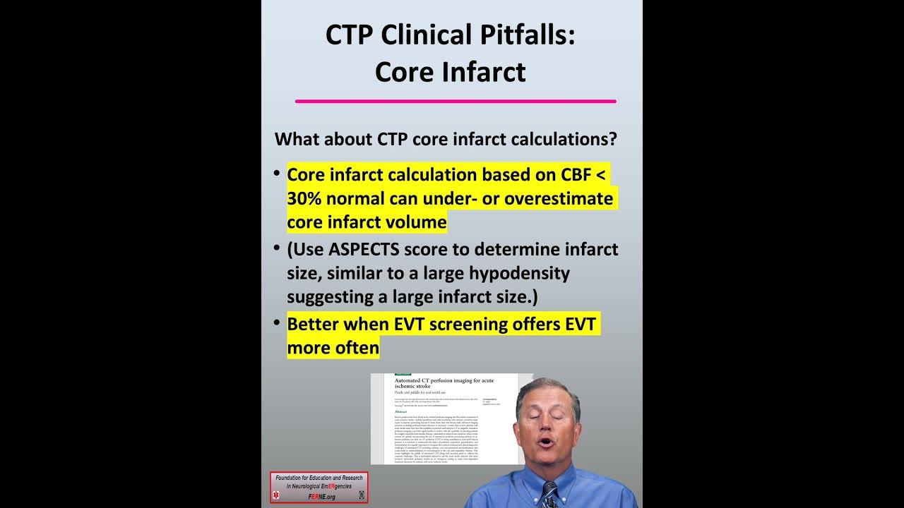 core-infarct-determination-cta-ctp-neuroimaging-in-acute-ischemic
