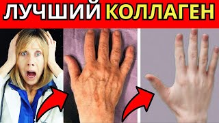 Как восстановить коллаген после 50 лет: секреты, которые вам не расскажут