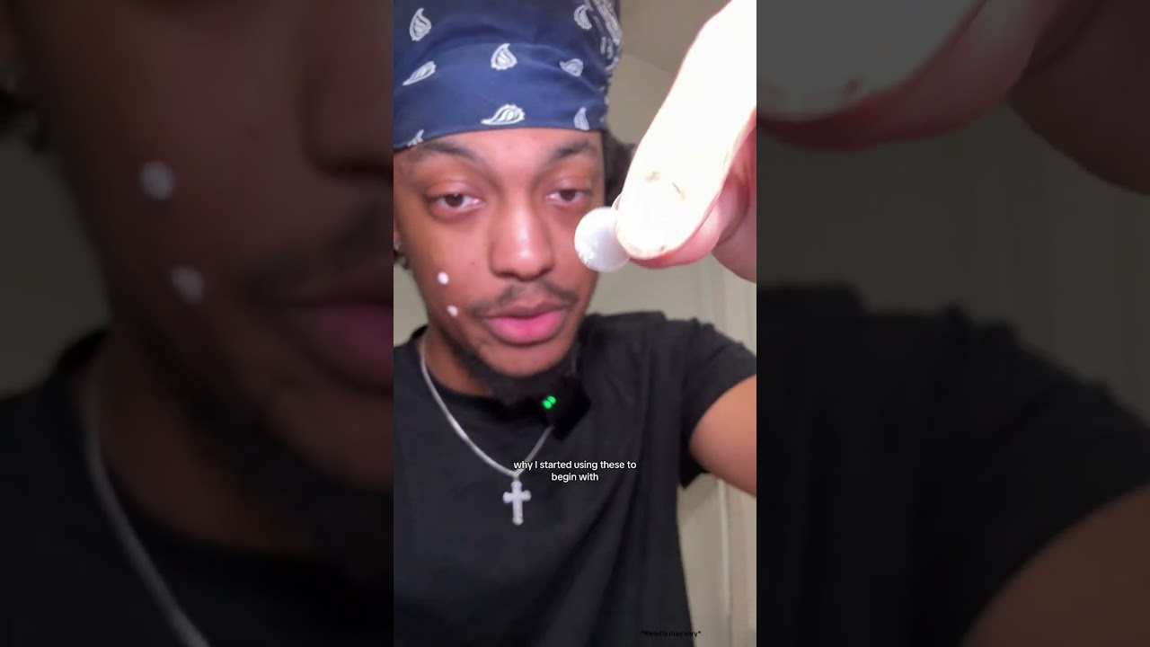 This mario badescu drying lotion is goated 🙌 sale ends tonight! 