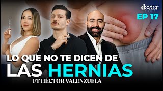 ¿Tienes una HERNIA y no lo sabes? Así puedes DESCUBRIRLO 👨‍⚕️🤯 FT Dr. Héctor Valenzuela.