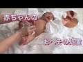 赤ちゃんのおへその処置