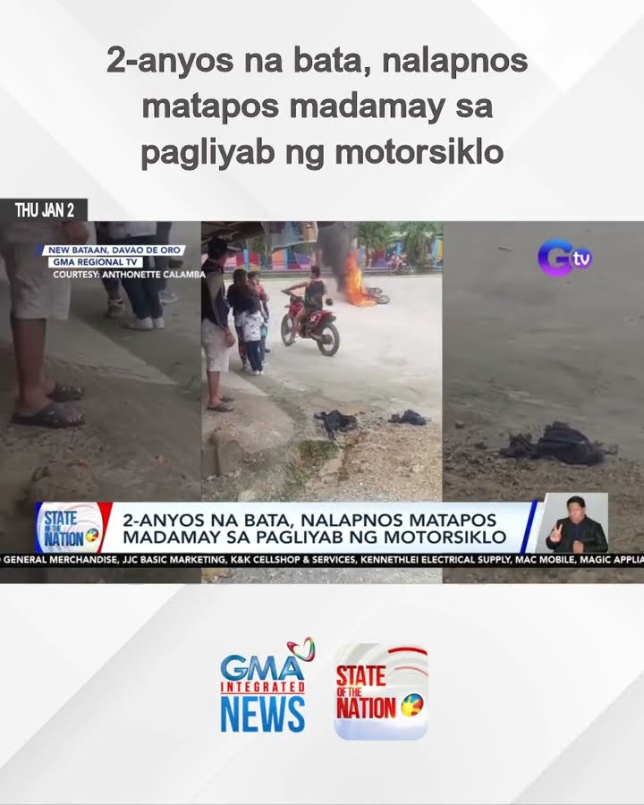 2-anyos na bata, nalapnos matapos madamay sa pagliyab ng motorsiklo | SONA
