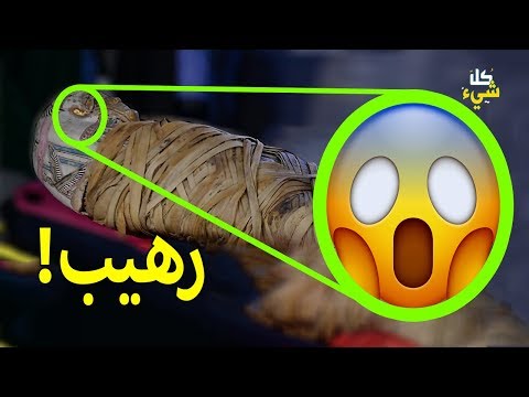 المرض الذي عجز الفراعنة عن اكتشافه وأذهل العالم