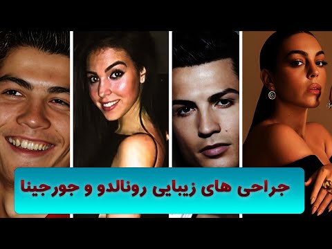 عمل های زیبایی رونالدو و جورجینا