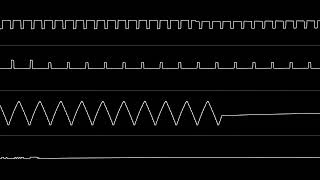 Yasuaki & Harumi Fujita - Mega Man 3 (NES) Full Soundtrack [Oscilloscope View]