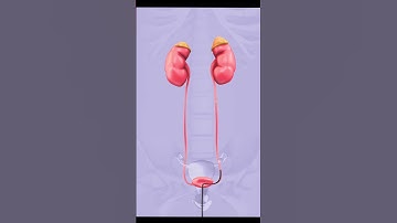Kidney Stones Demolished: Laser Lithotripsy #shorts #science #health