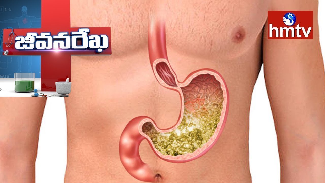 Solution for Gastric Problems | Homeocare International | Jeevana Rekha | Health News | hmtv