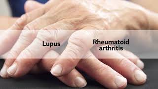 Autoreactive B Cells Are Activated By Chronic Bacterial Infection