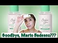 CARELINE SKIN ACNE DRYING LOTION REVIEW | Salamat nalang sa lahat Mario Badescu 😂 | Yna Parulan