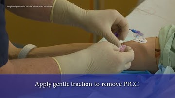 PICC Line Removal