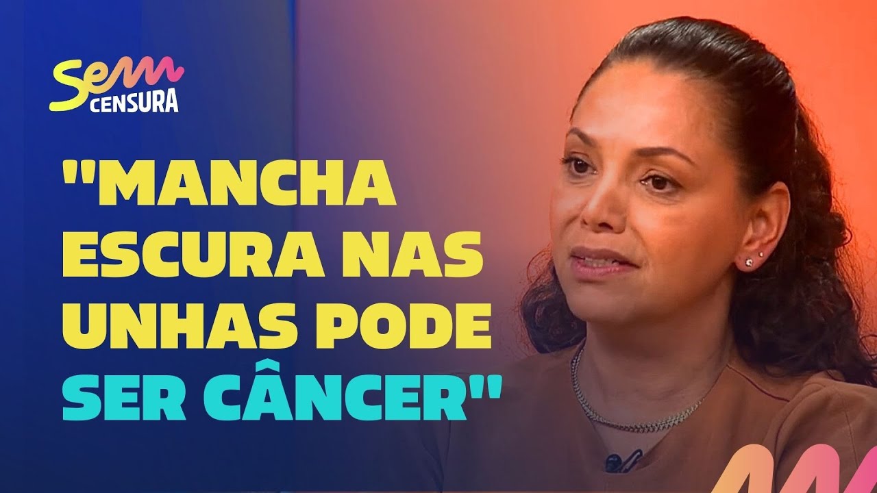 Sem Censura | A dermatologista Robertha Nakamura faz alerta sobre manchas nas unhas