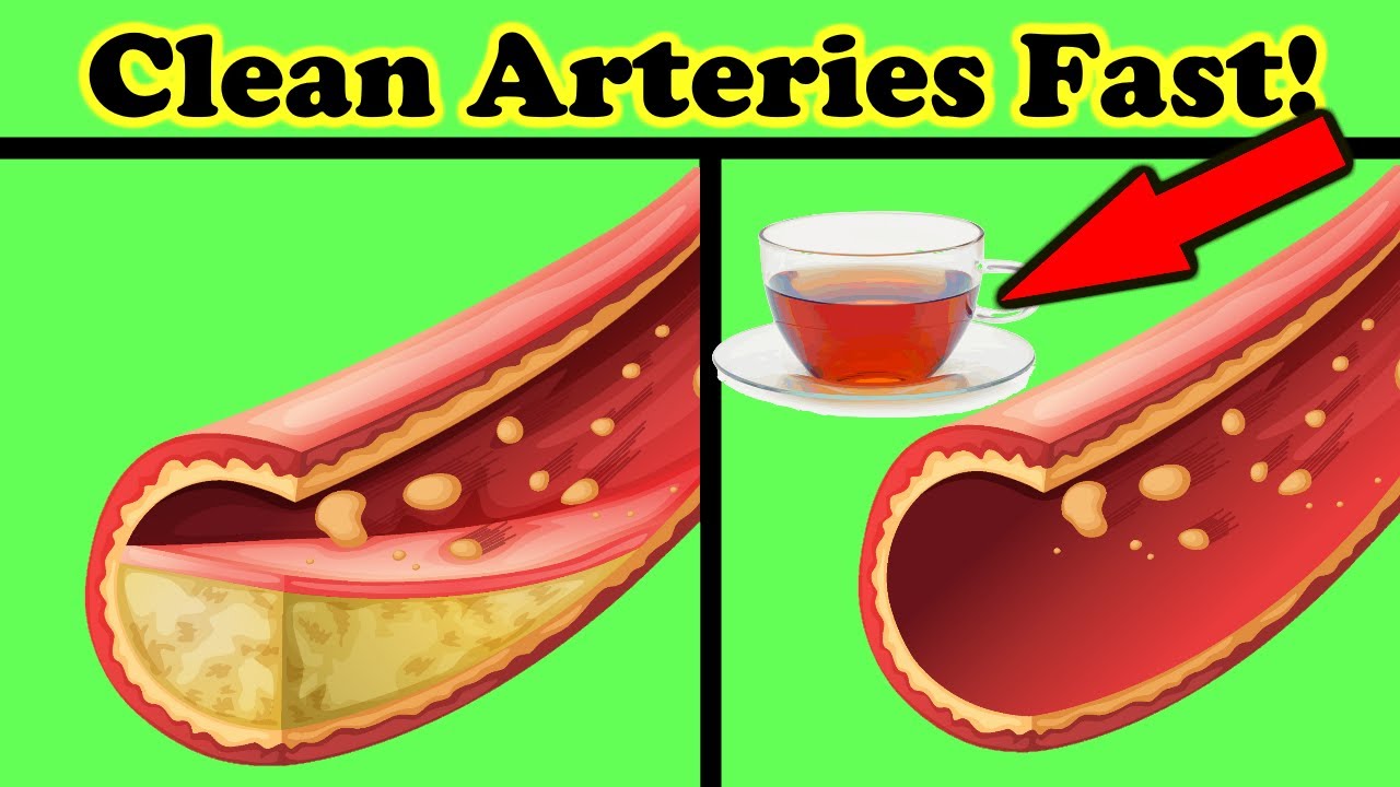 Drink This Everyday to Clean Arteries and Prevent Heart Attacks YouTube