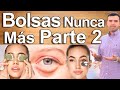 Ojeras y Bolsas en Los Ojos Parte 2 - Causas y Soluciones - EN VIVO