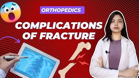 complications of fracture | types| causes| clinical features|therapeutic and physiotherapy approach.
