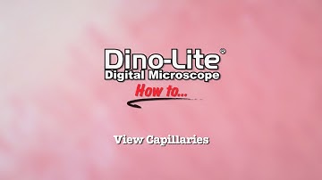 How to: View Capillaries using Dino-Lite USB Microscopes