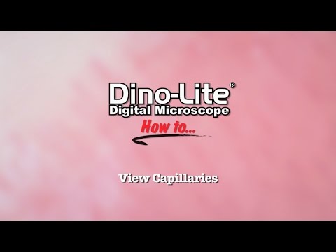 How to: View Capillaries using Dino-Lite USB Microscopes