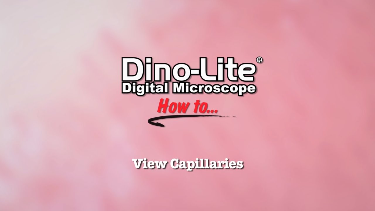 HF4113-EUT Dino-Lite Medical Otoscope 1.3MP Wireless Ready 