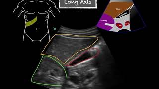 POCUS  Gallbladder Ultrasound Anatomy