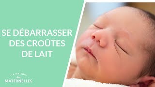 Croûtes de lait : comment s'en débarrasser ?