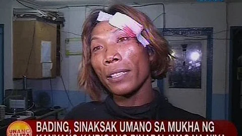 UB: Bading, sinaksak umano sa mukha ng kanyang kaibigang pinapalayas na niya