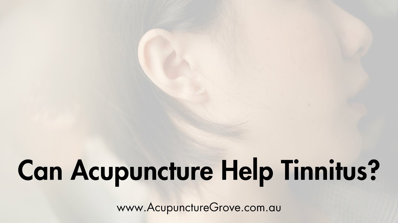 Can Acupuncture Help Tinnitus? Plus Qigong Exercise For Tinnitus