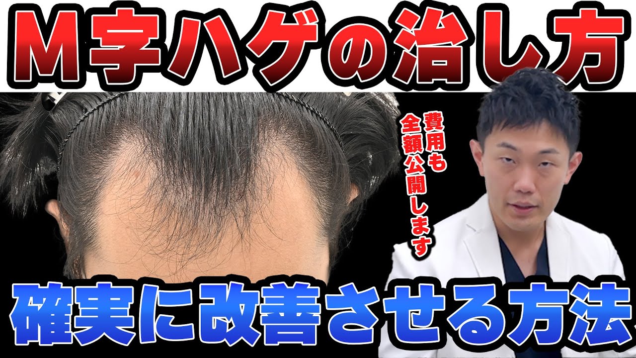 若年性M字ハゲ 総額公開】M字ハゲだけを確実に改善するAGA治療！ - 湘南AGAクリニック