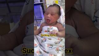 Sucking reflex #cutebaby #newbornbaby #nicu #babycare #reflex #sucking