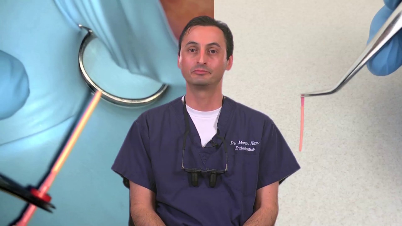 GuttaCore® Dr. Manor Haas Placement and Sealer Dentsply Sirona