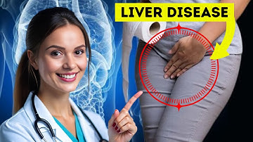 10 Early Warning Signs Your Liver Is Failing Don