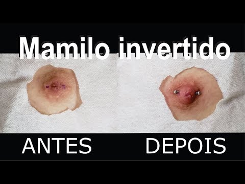 mamilo