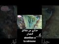 Atention De L Anémone Du Meditéranee Danger حذاري من شقائق النعمان في البحر خطر Atention De L Anémone Du Meditéranee Danger حذاري من شقائق النعمان في البحر خطر