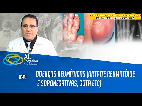 Vídeo: Gota E Artrite Reumatóide (AR): Você Pode Ter Os Dois?