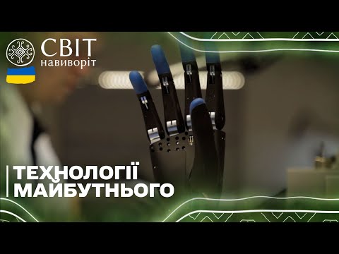 Надсучасний протез, який створили в Україні