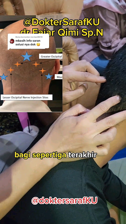 Pijat Vertigo dan Sakit Kepala Belakang. #sakitkepala #vertigo #doktersaraf #pijat #doktersarafku