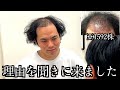 【植毛失敗?】34歳ハゲ、何故1592株しか植毛できなかったのか?