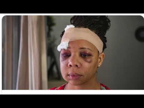 Headshots: How Israeli Military tactics are being used on U.S Protestors: Meet the Survivors