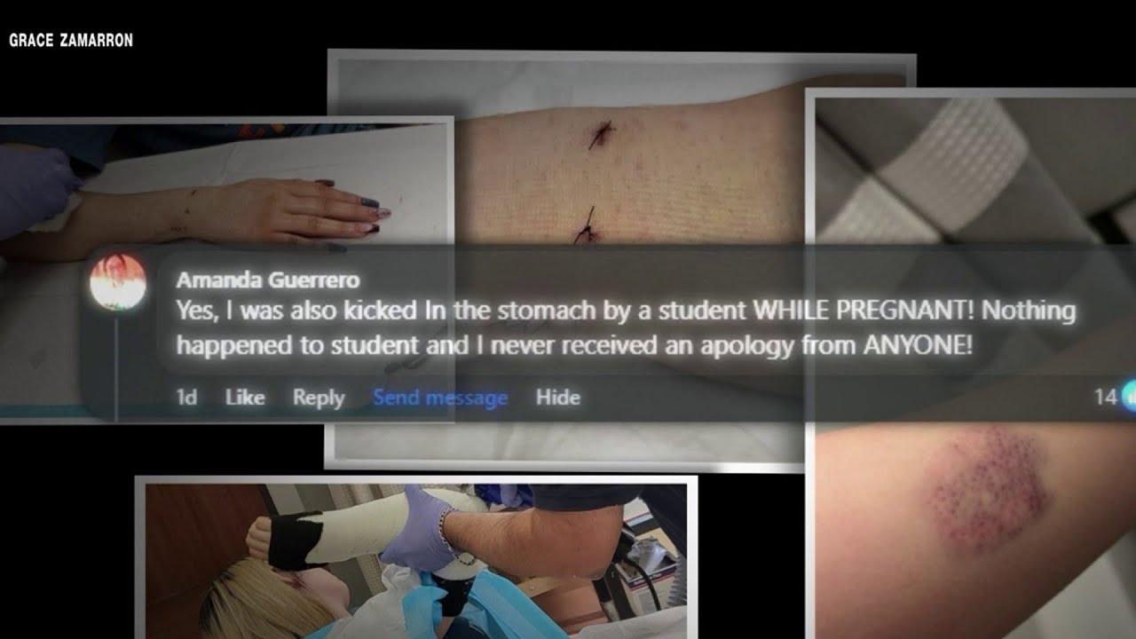TAINT／GRUNTschoolyard bruises SP-ED 41 Educators react to KSAT Investigates story on teacher's bruises