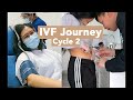 2nd IVF Cycle - Fresh Transfer (3DT), Low Ovarian Reserve | Our IVF Journey
