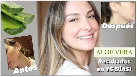 ¿Qué debo hacer antes de ponerme aloe vera en la cara?