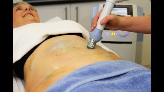 Shockwave Therapy | BTL XWave | Cellulite Treatment | Fat Reduction