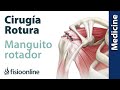Lesión del manguito rotador - Qué es, diagnóstico y tratamiento indicado en fisioterapia y cirugía