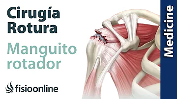 ¿Puede un fisioterapeuta saber si tiene un desgarro del manguito de los rotadores?