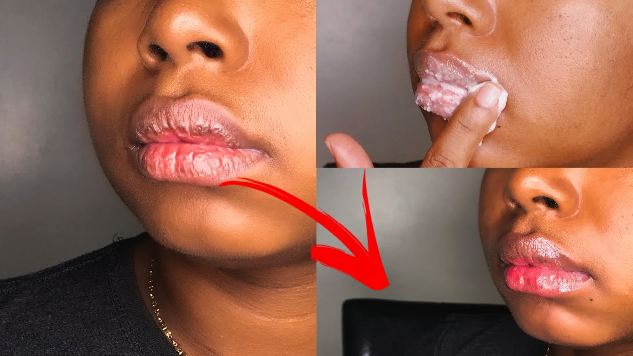 Lip care routine: **EXTREMELY** dry, cracked lips - YouTube