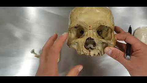 Em quais campos de estudo os pontos craniométricos são utilizados?