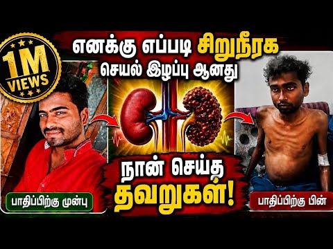 நான் செய்த தவறுகள் | எப்படி சிறுநீரக நோயால் பாதிக்கப்பட்டேன்? 😢 | என் உண்மை கதை