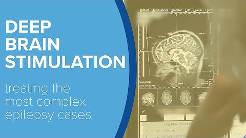 Deep Brain Stimulation For Epilepsy - Yale Medicine Explains