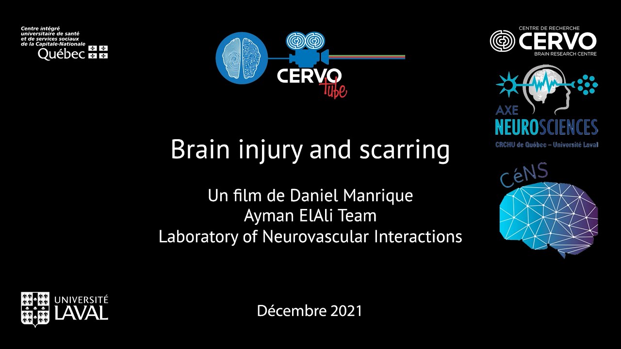 Brain injury and scarring YouTube