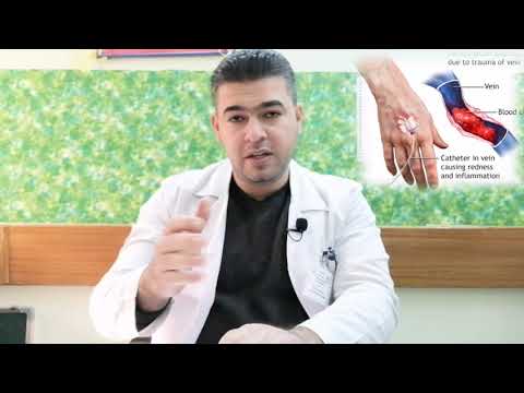 Thrombophlebitis التهاب الوريد الخثري